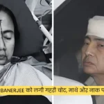 Mamata Banerjee को लगी गहरी चोट, माथे और नाक पर लगे टांके