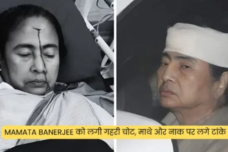 Mamata Banerjee को लगी गहरी चोट, माथे और नाक पर लगे टांके