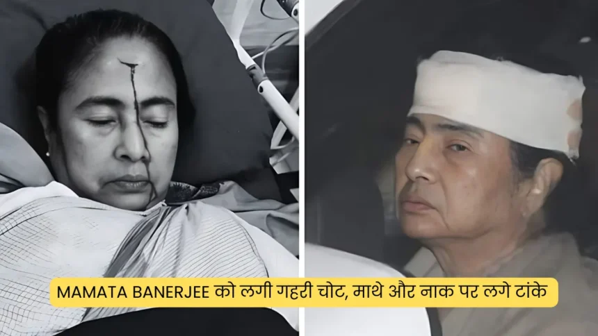 Mamata Banerjee को लगी गहरी चोट, माथे और नाक पर लगे टांके